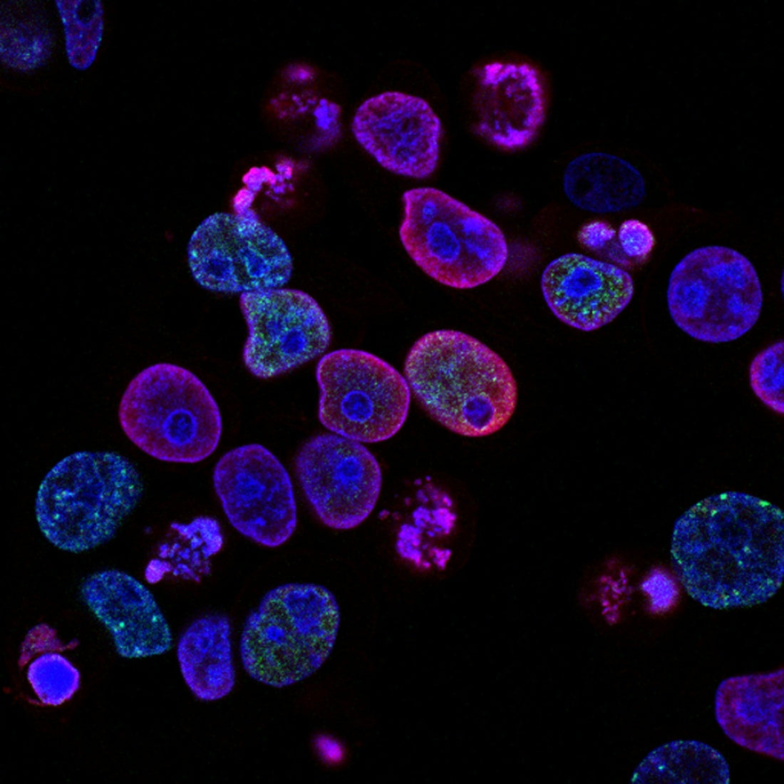 Zelluläre Energieproduktion in Mitochondrien